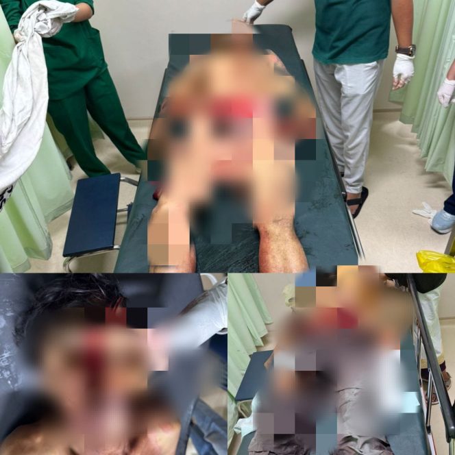 
					Perkelahian di Songan, Bangli: 2 Orang Meninggal Dunia dan 1 Orang Tangan Putus